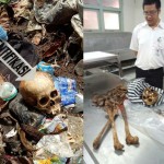 Kerangka Manusia Ditemukan di Tempat Pembuangan Sampah