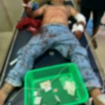 Ngurah Diana Dianiaya, Akibat Dendam.